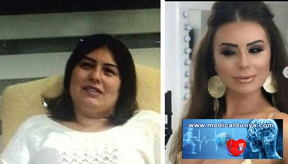 22'nci kez estetik ameliyatı oldu